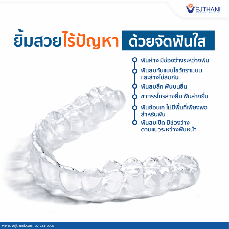 Smile confidently with Invisalign
