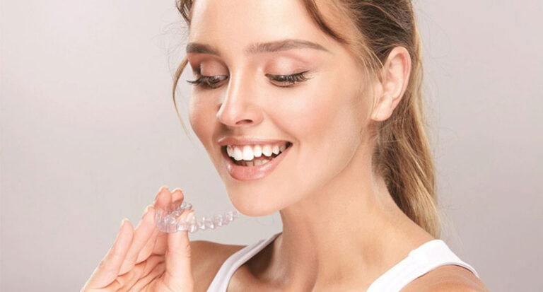 Invisalign Personal 3D Design: Correct Your Teeth to Their Ideal Position