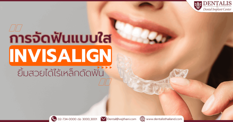 การจัดฟันแบบใส (Invisalign) ยิ้มสวยได้ไร้เหล็กดัดฟัน