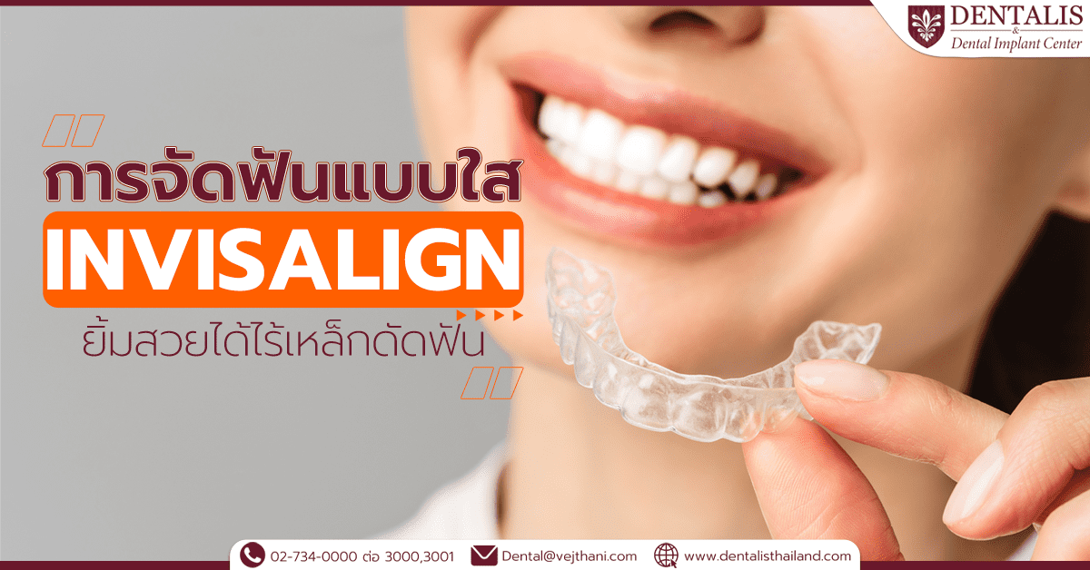 การจัดฟันแบบใส (Invisalign) ยิ้มสวยได้ไร้เหล็กดัดฟัน