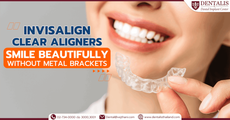 Invisalign Clear Aligners: Smile Beautifully without Metal Brackets