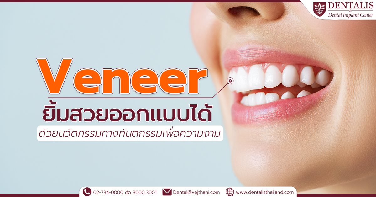 Veneer ยิ้มสวยออกเเบบได้ด้วยนวัตกรรมทางทันตกรรมเพื่อความงาม