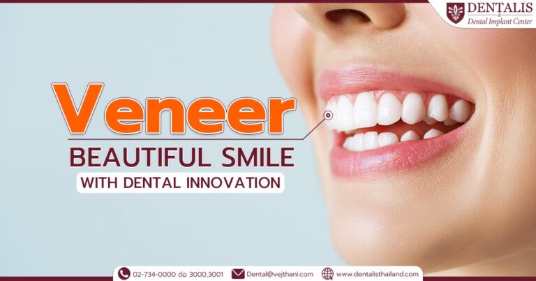 Veneers: Beautiful Smile with Dental Innovation