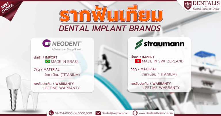 รากฟันเทียม Dental Implant brands