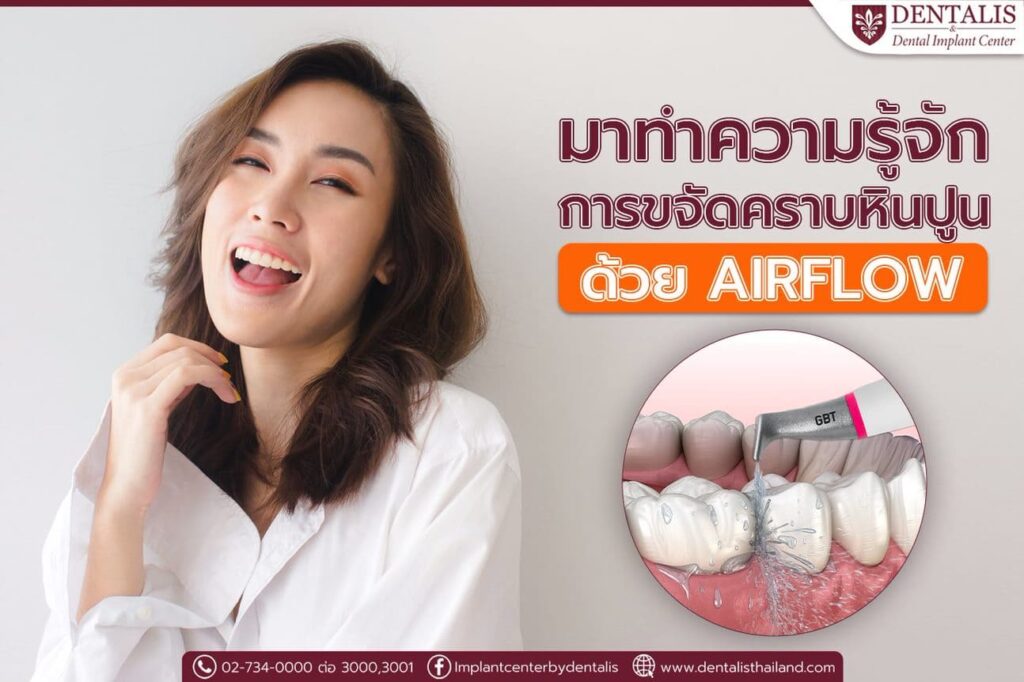 มาทำความรู้จักการขจัดคราบหินปูนด้วย Airflow