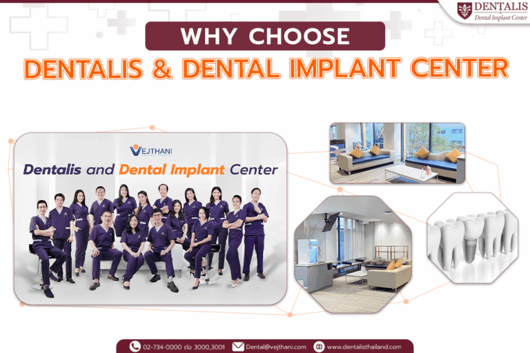 Why Veneers need to be done at Dentalis & Dental Implant Center