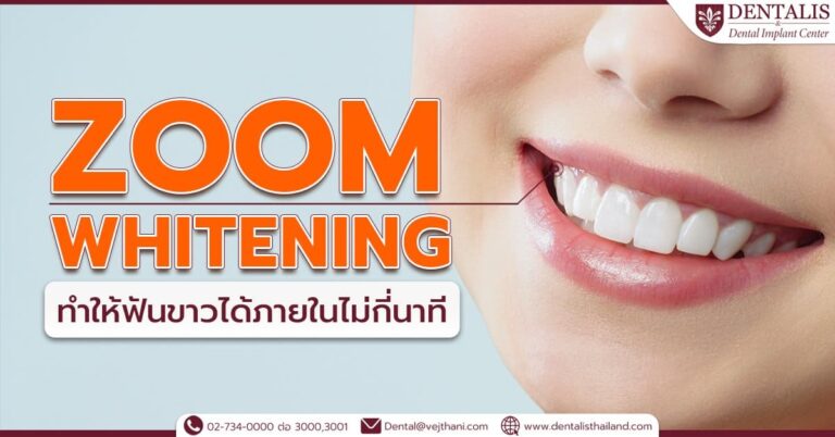 Zoom Whitening ทำให้ฟันขาวได้ภายในไม่กี่นาที
