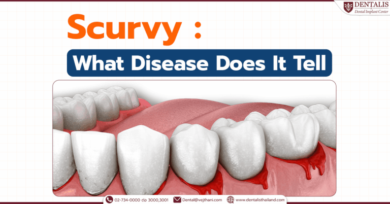 Scurvy: What Disorders Does It Tell?