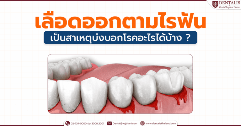 เลือดออกตามไรฟัน เป็นสาเหตุบ่งบอกโรคอะไรได้บ้าง ?
